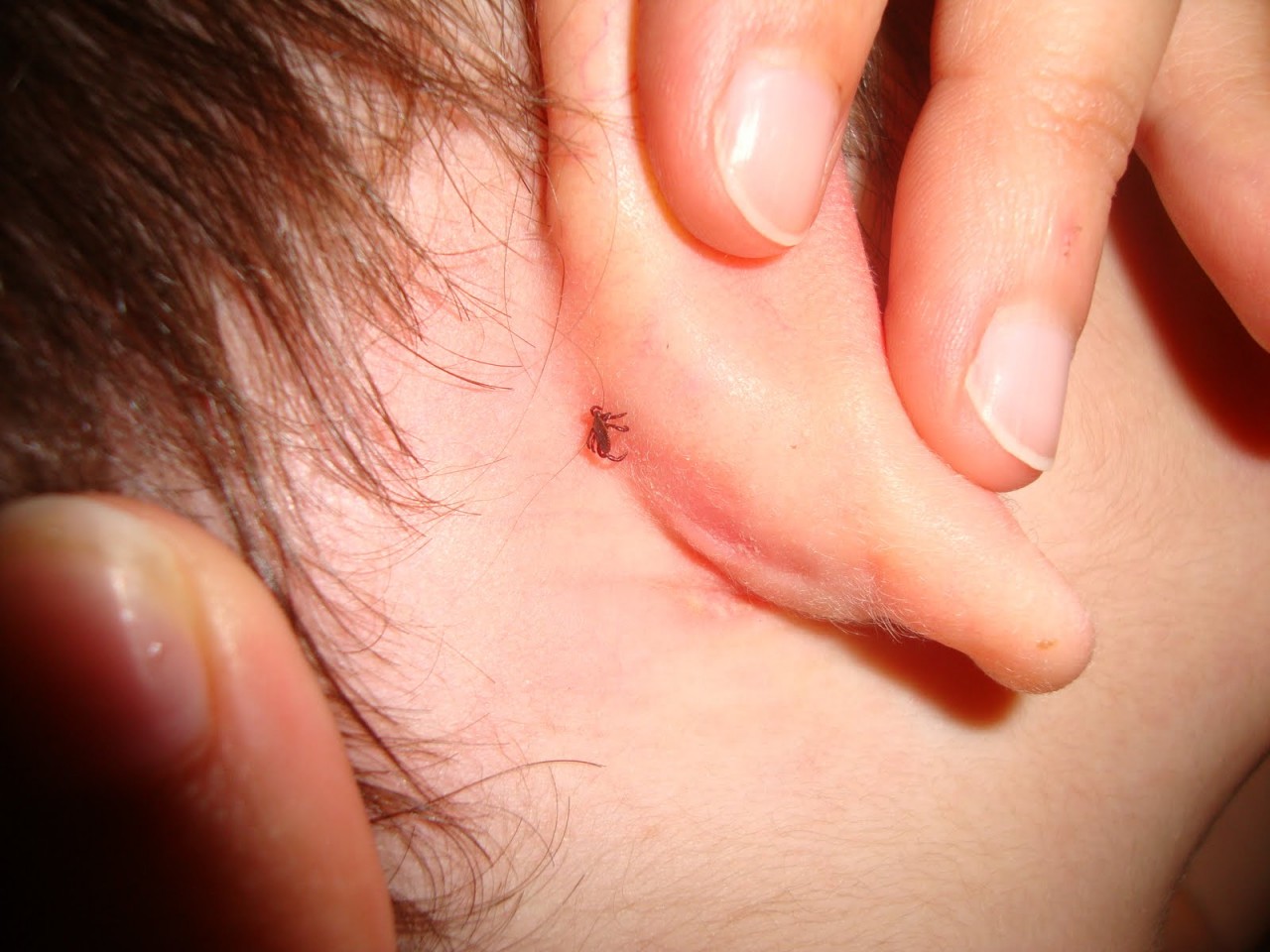 Investigadores da Universidade de Coimbra identificam enzima que poderá combater febre da carraça